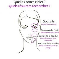 Quelles zones cibler quels resultats rechercher